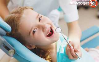 Черный налет на зубах у ребенка: причины и лечение