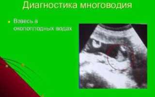 Околоплодные воды с мелкодисперсной взвесью