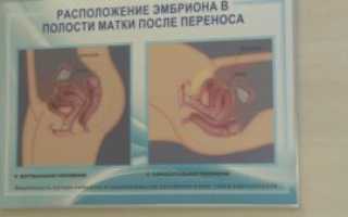 Сердцебиение после переноса эмбрионов