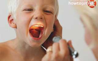 Аденоиды у детей: причины, симптомы и лечение