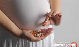 Цистит при беременности: причины, симптомы и лечение