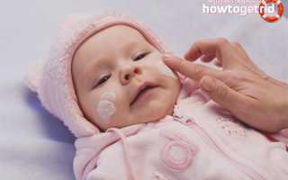 Диатез на щеках у ребенка — причины и лечение