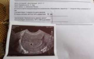Можно ли на узи увидеть беременность 1 неделя