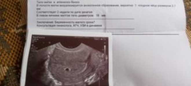 Можно ли на узи увидеть беременность 1 неделя