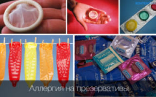 Аллергия на презервативы у мужчин