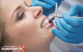 Что делать, если крошатся зубы: причины и лечение