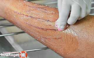 Чем обработать царапины от кошки?