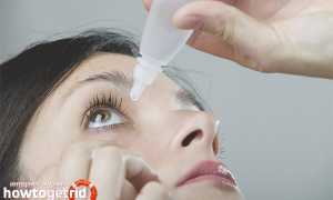 Болят глаза: что делать в домашних условиях?