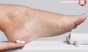 Что делать, если болят пятки: полезные советы