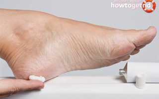 Что делать, если болят пятки: полезные советы